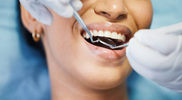 Best Urgent Care for Lost Fillings or Crowns in Unicoi, TN